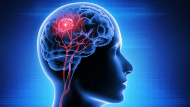 تومور مغزی : انواع،علائم و روش های تشخیص و درمان