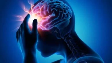 سکته مغزی چیست؟ علائم، علت، تشخیص و درمان آن