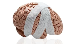 ضربه مغزی چه علائمی دارد؟ تشخیص و درمان آن