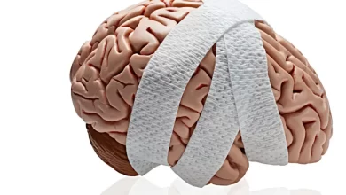 ضربه مغزی چه علائمی دارد؟ تشخیص و درمان آن