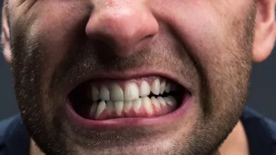 دندان قروچه درخواب محافظ دندان قروچه