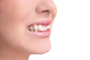 کشیدن دندان نیش