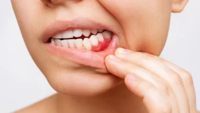 درمان گیاهی دندان